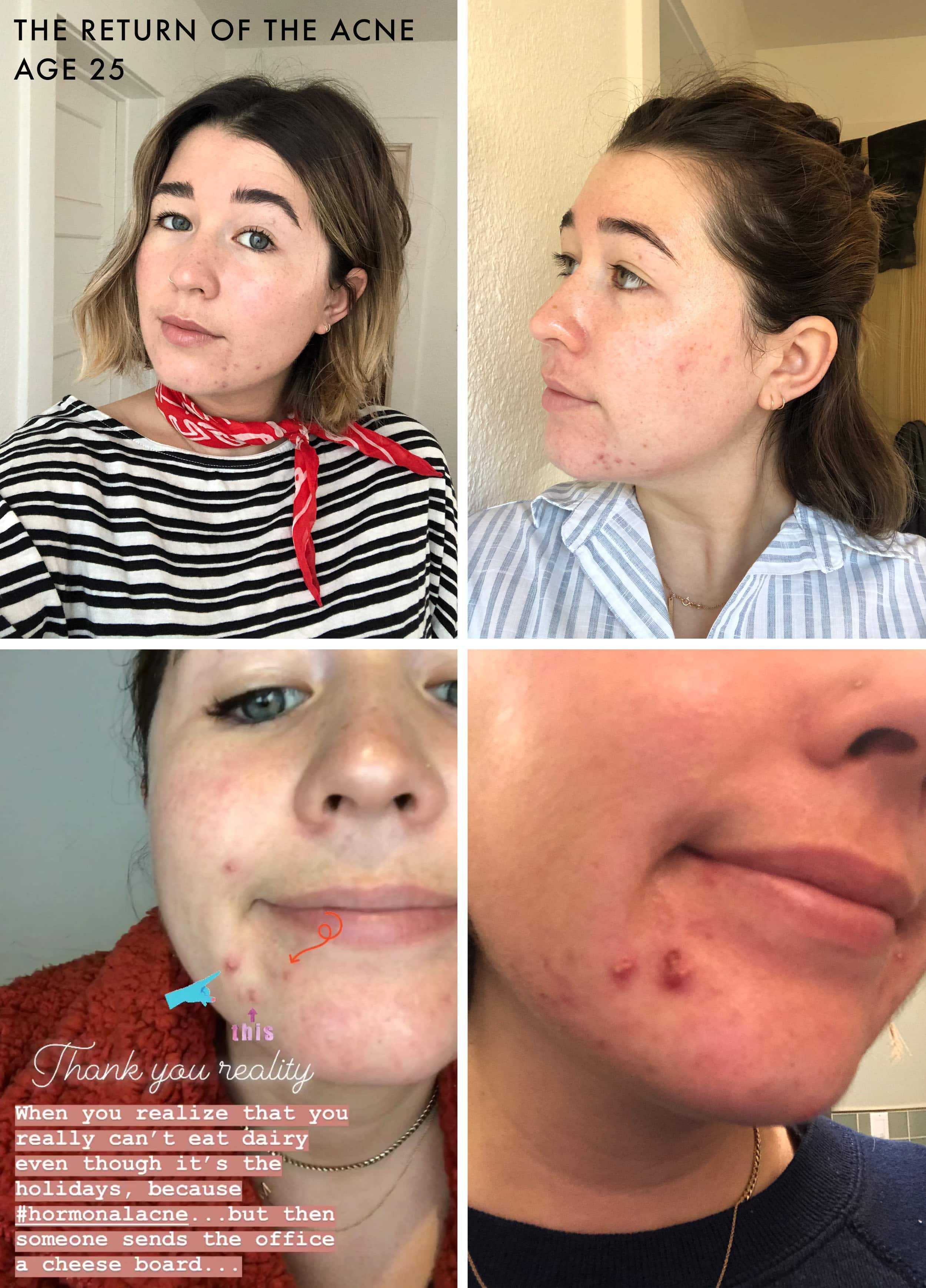 Emily Henderson Sara Beauty Skincare Graphic 25 Year Old Sara
