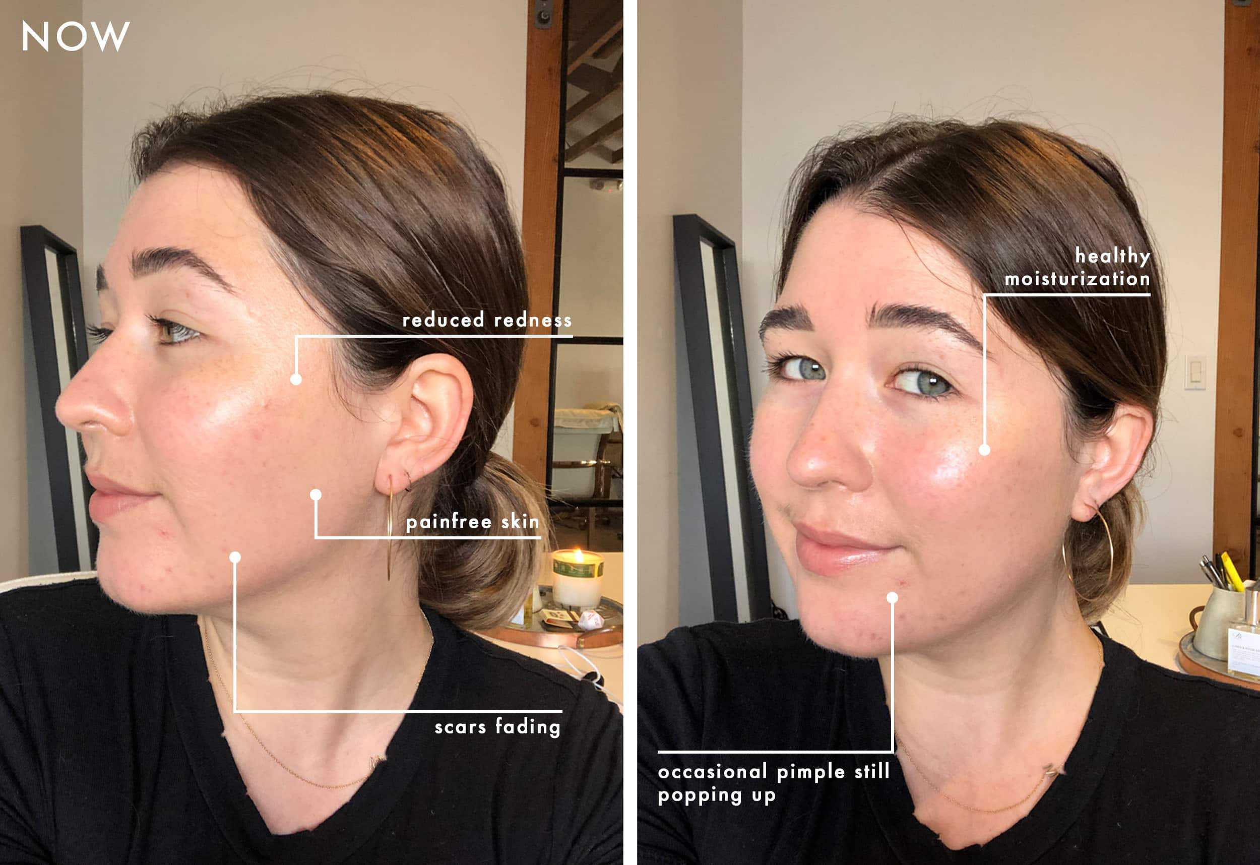 Emily Henderson Sara Beauty Skincare Graphic Now Sara 1